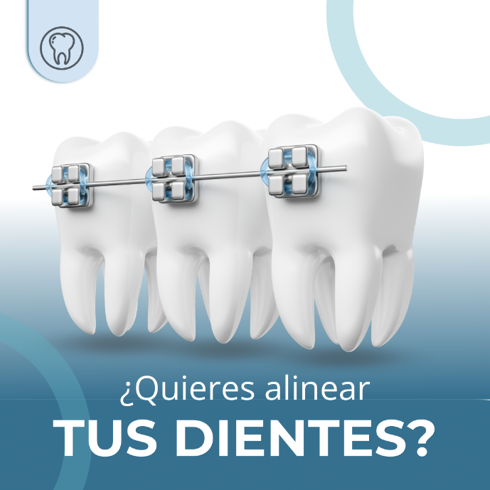 No ocultes mas tu sonrisa por verguenza! En clinica dental Heins tenemos a los mejores ortodoncistas